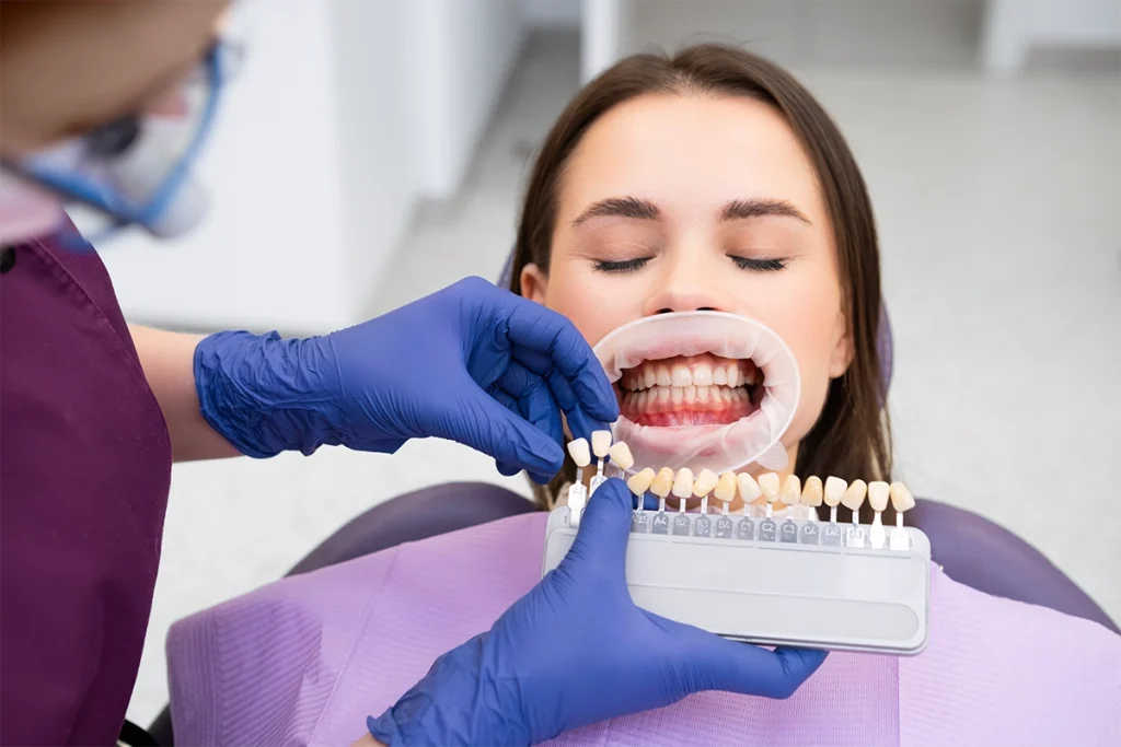 Paciente con carillas dentales sonriendo