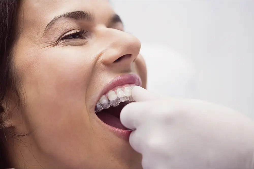 control dental post ortodoncia