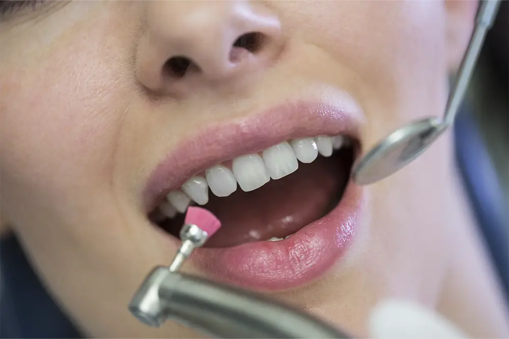 paciente en fluoración dental