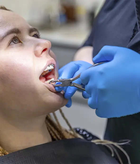 Desinstalación de brackets