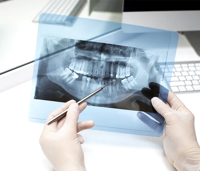 rx para evaluar complejidad ortodoncia