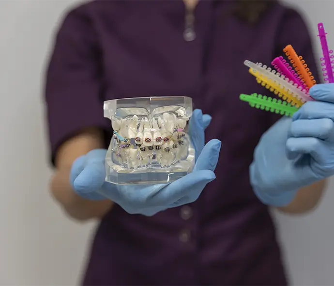dientes apiñados