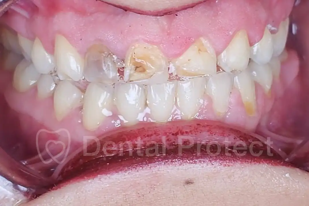 diseno-sonrisas-antes-1