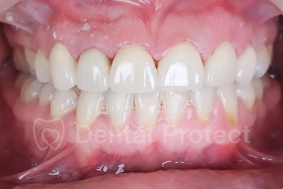 diseno-sonrisas-despues-1