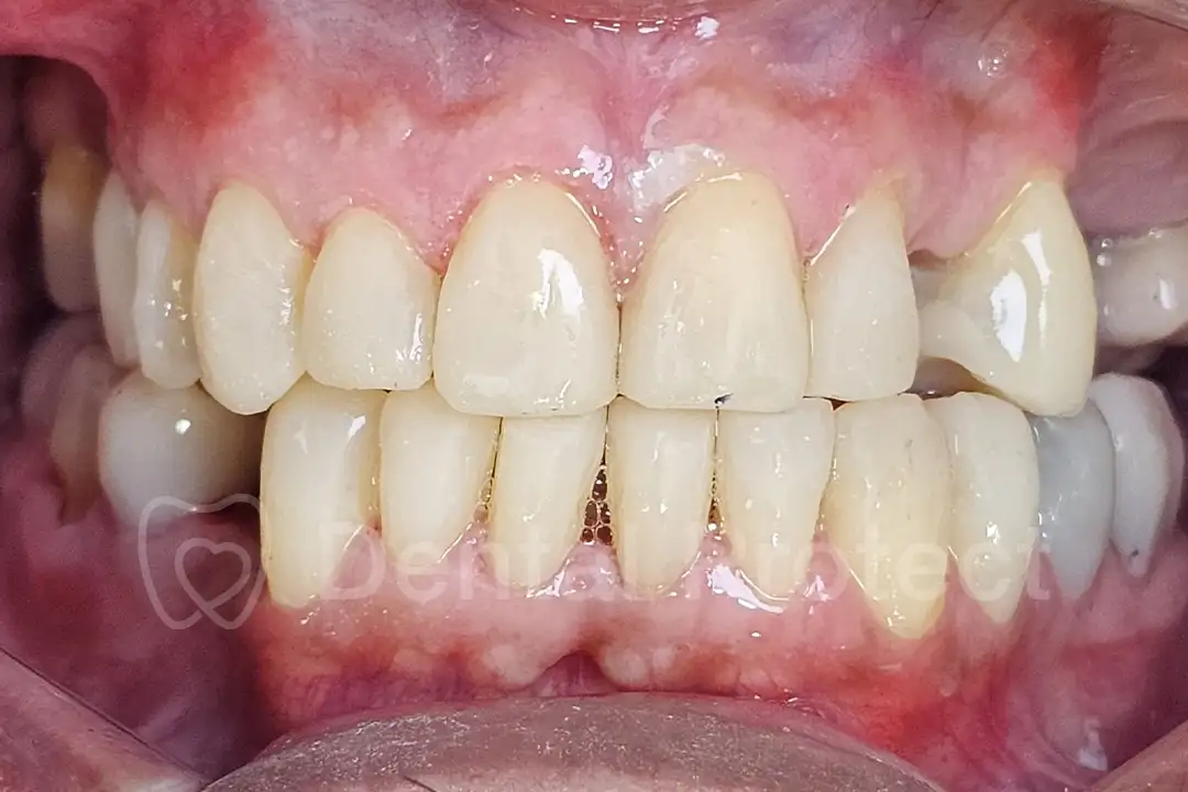 diseno-sonrisas-despues-2