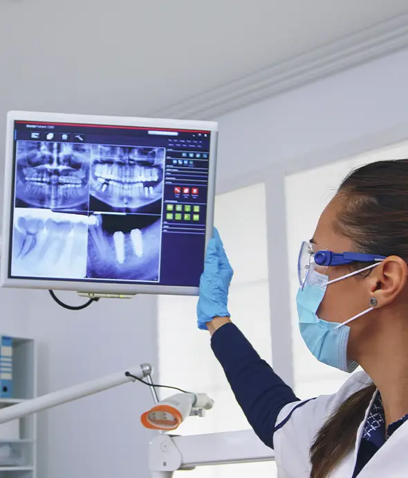 revisión de rx para tratamiento dental