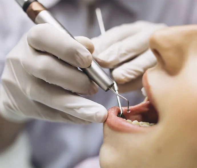 Boca primer plano tratamiento dental